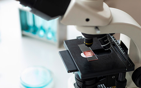 pathology -Diagnolounge-Goregaon-Mumbai